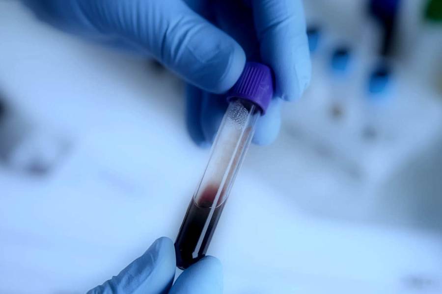 Evde Kan Tahlili Güvenli mi?